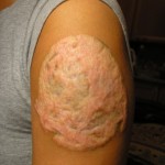 Advices and negative consequences of tattoos